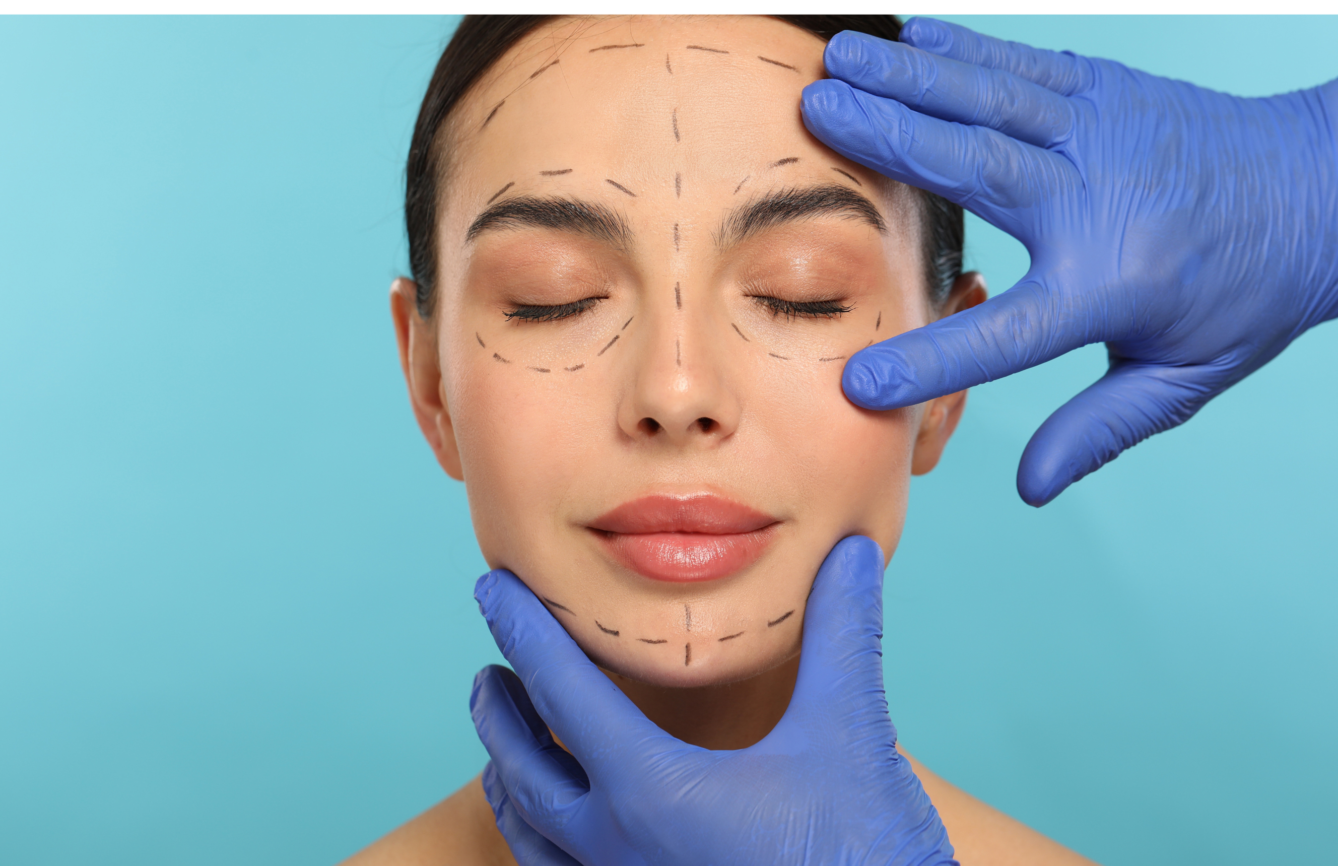 Dermavers Clinic Treatment FACE SCULPTING